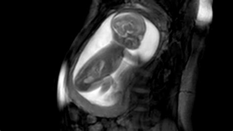 Detailed Images Of Baby Heart Inside The Womb Bbc News