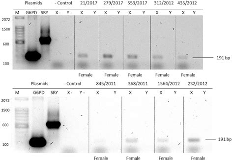 Sex Typing Of Unknown Individuals By Pcr Ethidium Bromide Stained 08 Download Scientific