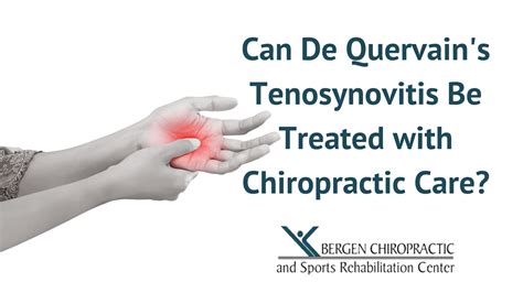 Can De Quervains Tenosynovitis Be Treated By Chiropractors
