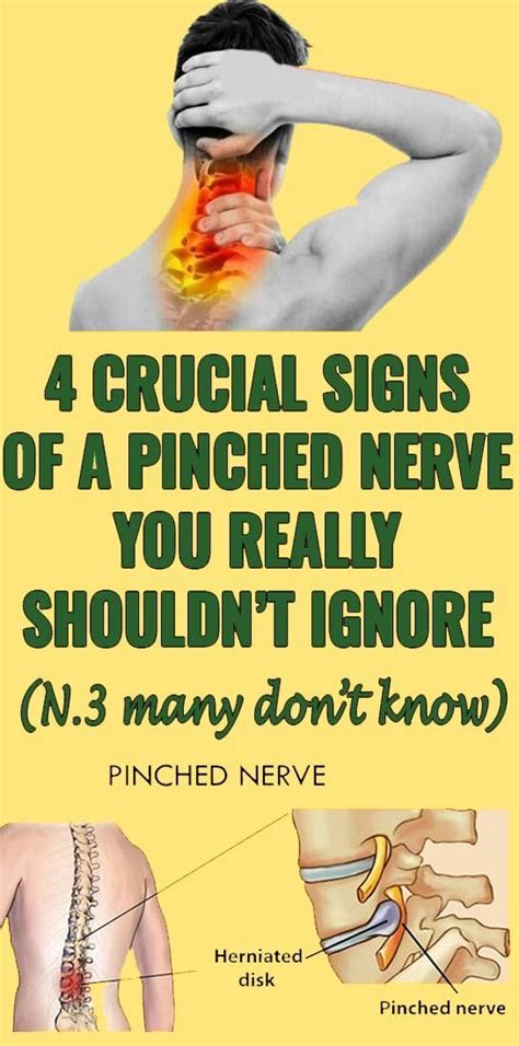 4 Crucial Signs Of A Pinched Nerve You Really Should’t Ignore Pinched Nerve Nerve Problems