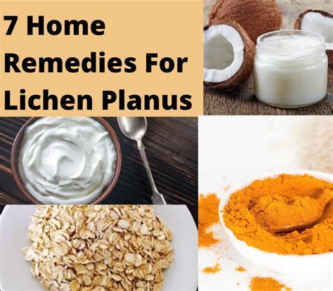 7 Home Remedies For Lichen Planus Lifeforce