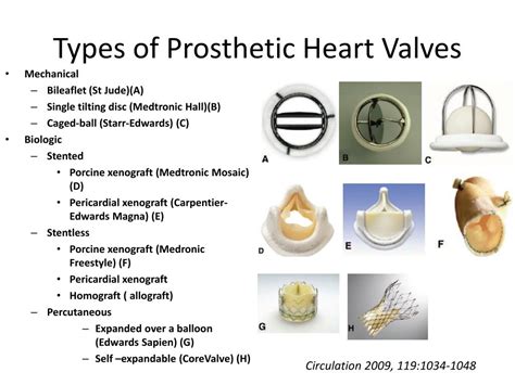 Ppt Recommendations For The Echocardiographic Evaluation Of