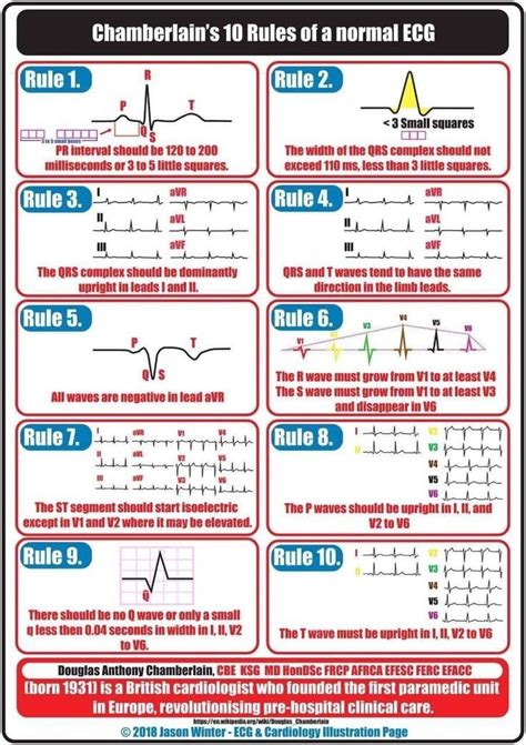 Chamberlains 10 Rules Of A Normal Ecg Infographic Emergency