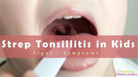 What Moms Should Know About Strep Tonsillitis