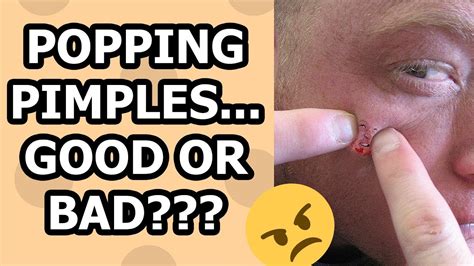 Popping Pimples The Things You Should Know Youtube