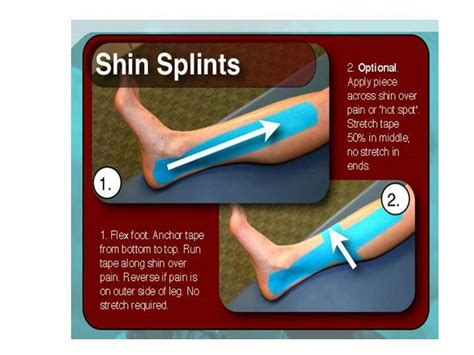 Shin Splints With Terra Tape Shin Splints Kinesiology Taping Shin