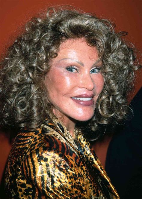 The Famous Life And Face Of Jocelyn Wildenstein