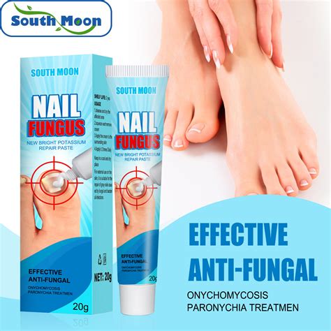 Nail Fungus Treatment Cream Onychomycosis Paronychia Anti Fungal Nail