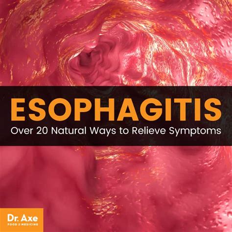 Esophagitis Causes Symptoms And Natural Self Care Dr Axe