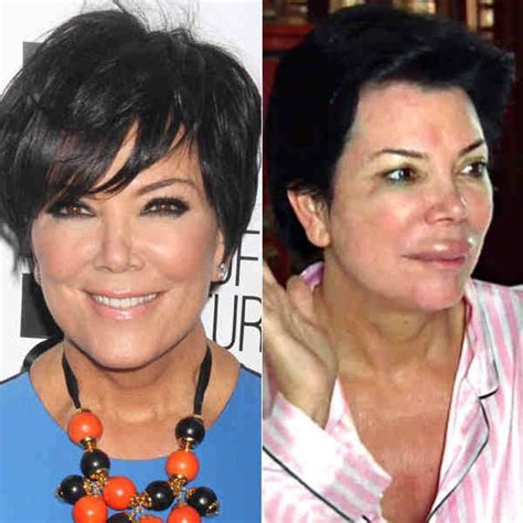 See The Kris Jenner Plastic Surgery Kris Jenner Plastic Surgery Plastic Surgery Before And