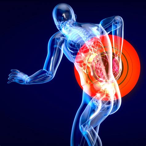 ¿qué Es La Espondilolistesis Degenerativa Centro Médico Osi