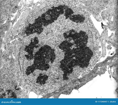 Electron Microscope Images Of Chromosomes