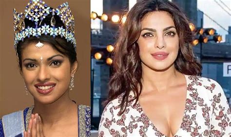 Bollywood Celebrities Before And After Plastic Surgery Part I