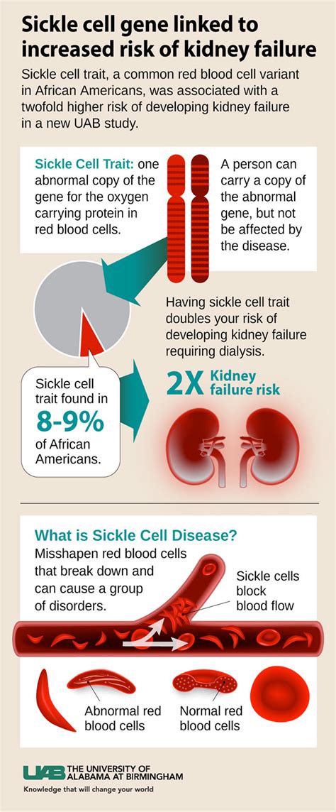 Sickle Cell Gene Linked To Elevated Risk Of Kidney Failure In Uab Study
