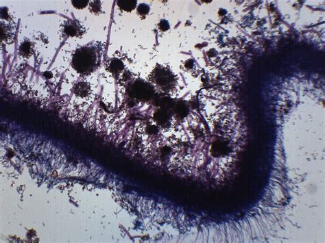 Aspergillus Brown Mold Prepared Microscope Slide 75x25mm
