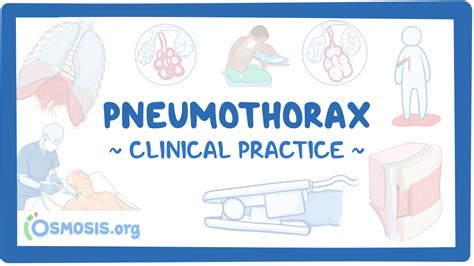 Pneumothorax Clinical Sciences Osmosis Video Library