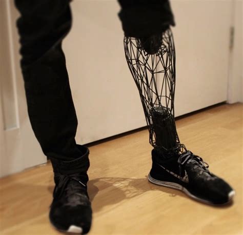 William Root 3dprinted Exo Prosthetic Leg Designed To Be Affordable