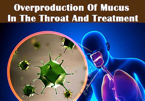 Constant Phlegm Throat Overproduction Of Mucus In Throat And Treatment