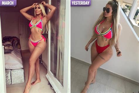 Chloe Ferry S Dramatic Transformation After Second Boob Job And