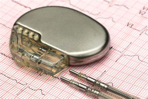 Boston Scientific Pacemaker Glitch May Cause Fainting Daily Hornet