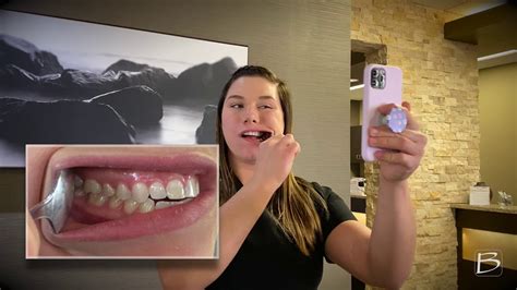 Orthodontic Selfies Bubon Orthodontics Youtube