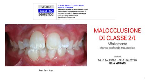 Studio Dentistico Balestro Malocclusione Di Classe 2 1
