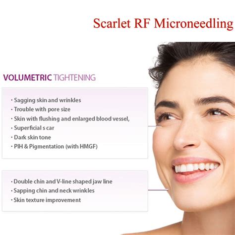 Rf Microneedling Face Multiples Of 3 Allurant Medical Spa