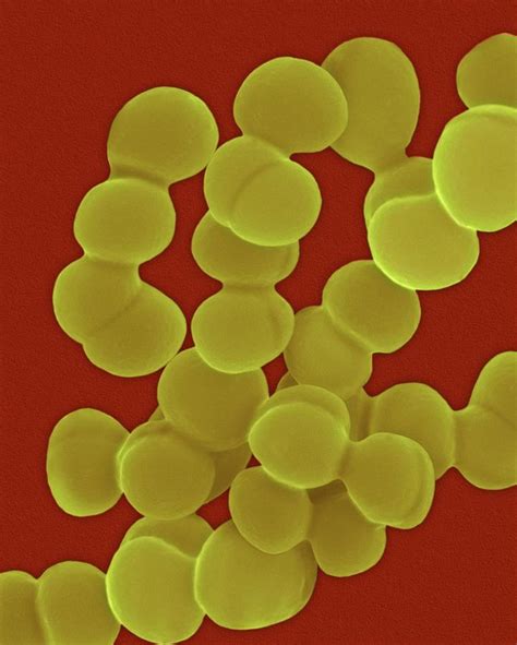 Streptococcus Viridans 1 Photograph By Dennis Kunkel Microscopy