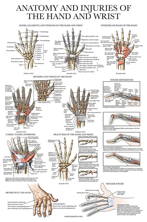 Laminated Anatomy And Injuries Of The Hand And Wrist Poster Hand And