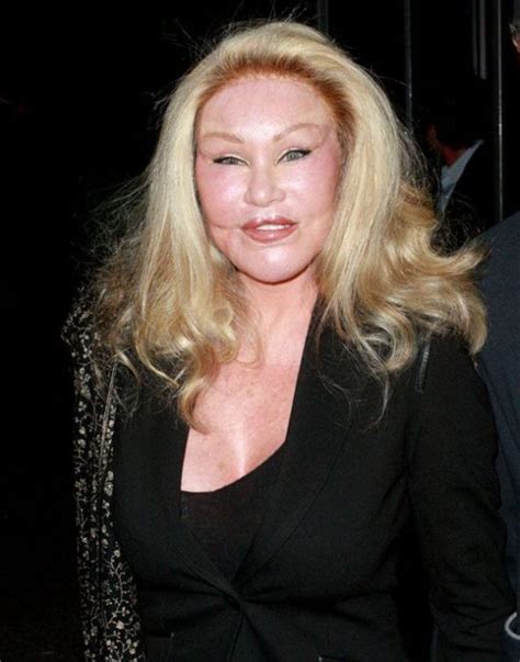 Jocelyn Wildenstein Plastic Surgery Before And After Face Photos