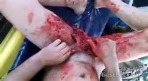 Castration - Best Gore. 