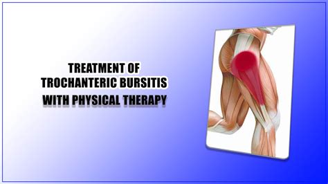 Expert Guide About The Treatment Of Trochanteric Bursitis With Physical Therapy Oklahoma
