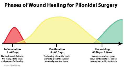 Wound Healing In Depth Pilonidal Support Alliance