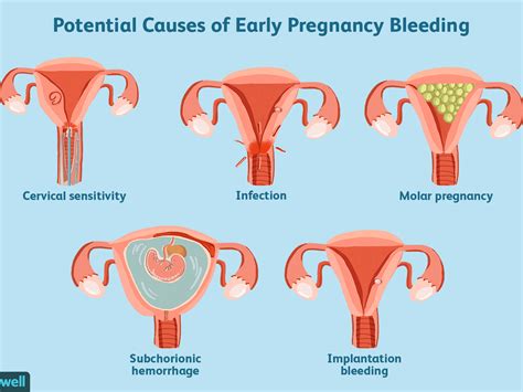 Light Pink Discharge When I Wipe What Is Your Period Blood Telling