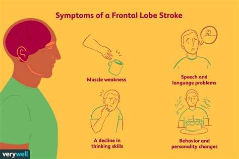 Les Effets Dun Avc Du Lobe Frontal Fmedic