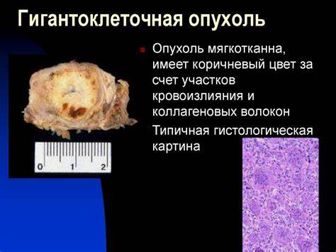 Заболевания костей диета Опухолеподобные заболевания костей. Дифференциальная диагностика Опухолеподобные заболевания костей. Дифференциальная диагностика Заболевания костей диета