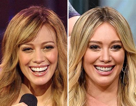 Celebrity Teeth Before And After The Steve Harvey Morning Show