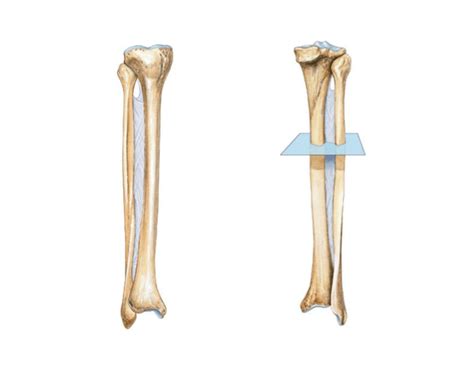 The Fibula & Tibia (anterior & posterior views)
