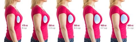Choosing The Best Breast Implant Cc Size Vs Bra Cup Size Breast