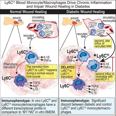 Ly6chi Blood Monocytemacrophage Drive Chronic Inflammation And Impair