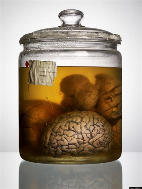The Photographer Behind The Missing Texas Brains Explains How Media Got