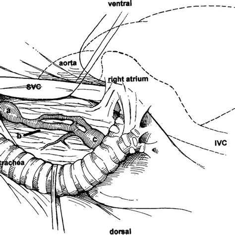 Anatomy Of Variation 1 Right Lateral Thoracotomy 2nd To 5th Rib
