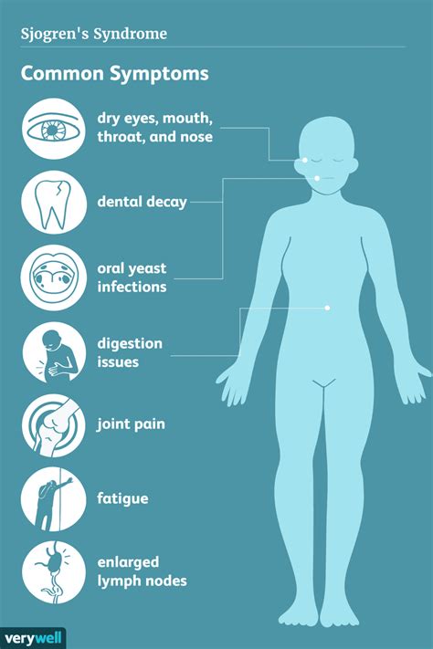 Sjogrens Syndrome Symptoms Causes Diagnosis And Treatment
