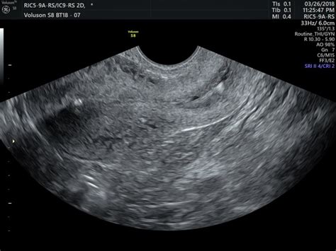 Fertility Scan Private One On One Pregnancy And Fertility Ultrasound