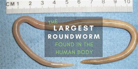 Ascaris The Largest Roundworm Are There Worms Living In Your Gut Free