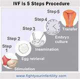 Ivf Treatment Process Timeline Images