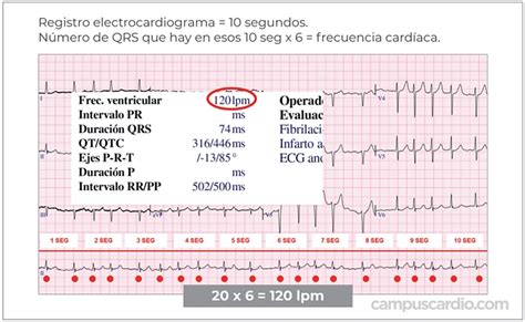 Calcule la frecuencia cardíaca en este electrocardiograma