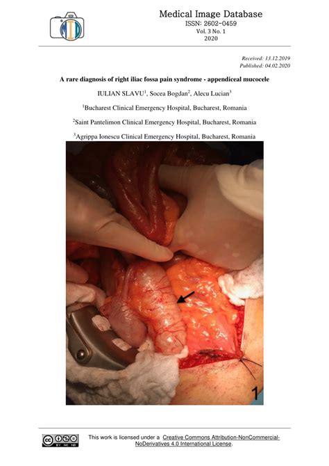 Add your reflection on what you learned from this page and how it relates to your practice: (PDF) A rare diagnosis of right iliac fossa pain syndrome ...