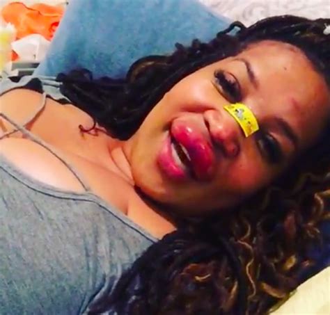 Kym Whitley Reveals Graphic Footage Of Her Swollen Lip After Tripping And Falling In Hole I M