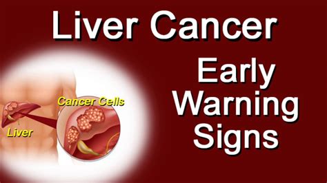 Liver Cancer Early Warning Signs Youtube